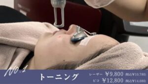 トーニング　レーザー9800円（税込10,780円）　ピコトーニング12,800円（税込14,080円）