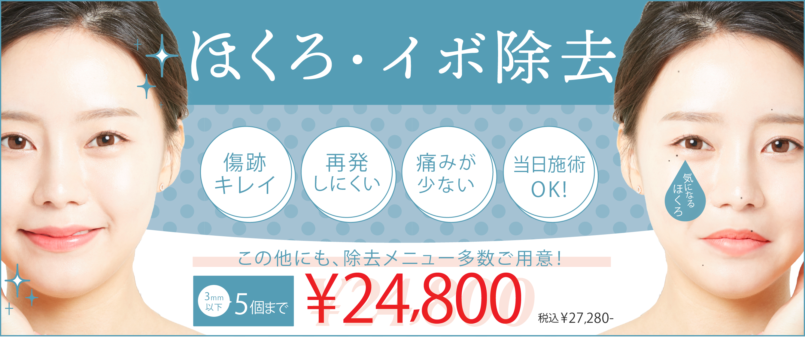 気になるほくろ・イボ除去。3㎜以下5個まで24,800円。傷跡キレイ・再発しにくい・痛みが少ない・当日施術OK!ただおかメディカルクリニック美容皮膚科