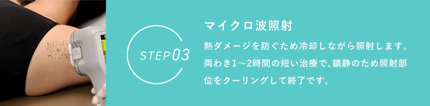 ワキガ・多汗症治療 ミラドライ STEP3 マイクロ派照射 熱ダメージを防ぐため冷却しながら照射します。両わき1〜2時間の短い治療で、鎮静のため照射部位をクーリングして終了です。