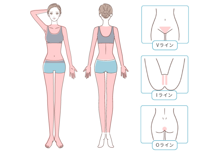 ミセルクリニック岸和田院（ただおかメディカルクリニック併設美容皮膚科）の全身脱毛+VIOの部位対応エリア