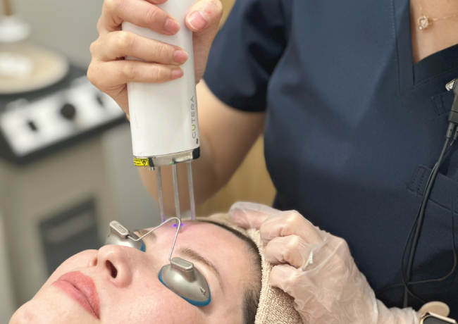 シミ取り放題治療のフォトナQX「Fotona QX」の施術画像