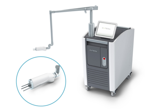シミ取り放題治療のフォトナQX「Fotona QX」の施術画像